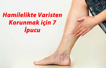 gebelikte varis