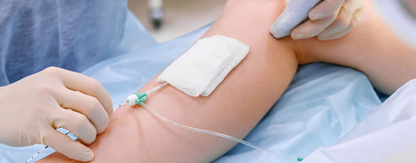 Lazerle Varis Tedavisi