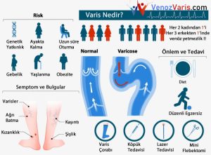 Varis Nedir ve çeşitli bilgiler