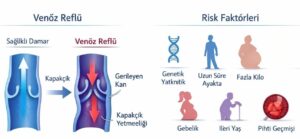 Varis Zamanla Geçer mi, Yoksa İlerler mi?