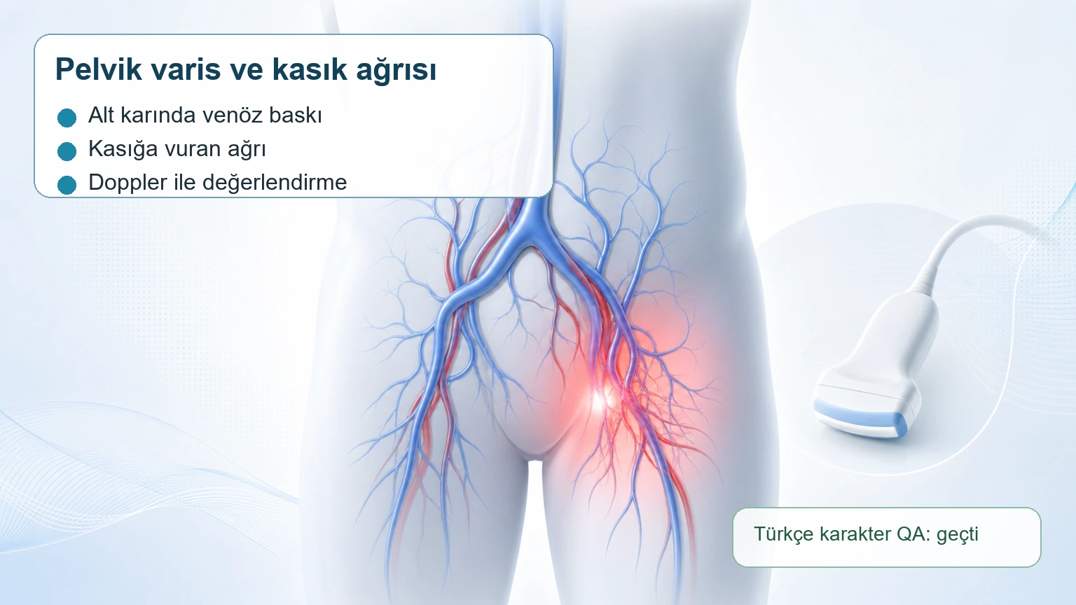 Pelvik varis ve kas?k a?r?s? ili?kisini g?steren T?rk?e a??klamal? t?bbi g?rsel.