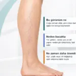 Bacakta Mor Damarlar Ne Anlama Gelir? Kılcal Varis mi, Venöz Yetmezlik mi? için bacakta ince mor-kirmizi damar aglarinin neden daha gorunur hale geldigini açıklayan premium medikal görsel