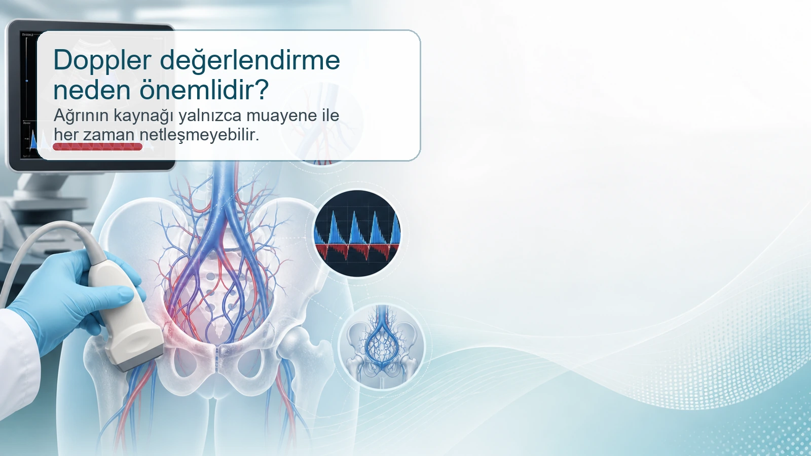 Pelvik venöz sorunlarda Doppler değerlendirmenin önemini gösteren tıbbi illüstrasyon