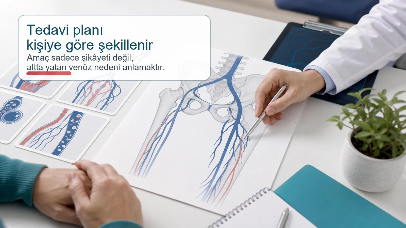 Pelvik venöz konjesyonda kişiye özel tedavi planlamasını anlatan tıbbi illüstrasyon