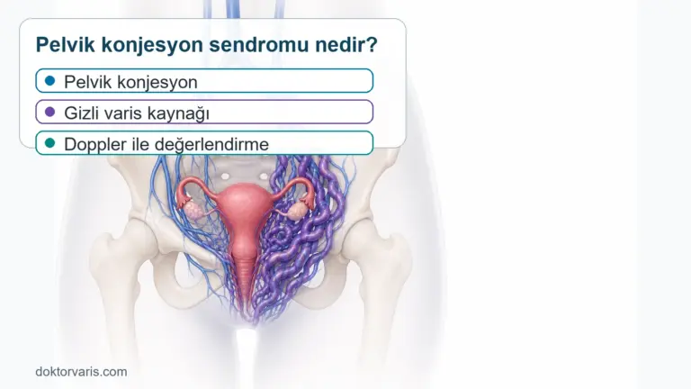 Pelvik Konjesyon Sendromu Nedir? Kadınlarda Gizli Varis Kaynağı