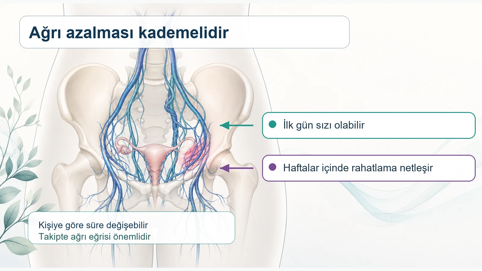 Pelvik konjesyon tedavisi sonrası ağrının kademeli azalmasını gösteren tıbbi illüstrasyon.
