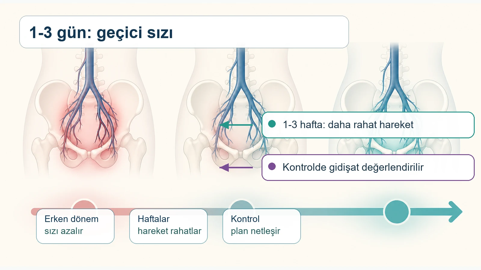 Pelvik konjesyon tedavisi sonrası ilk günlerden haftalara uzanan ağrı azalması sürecini gösteren tıbbi görsel.