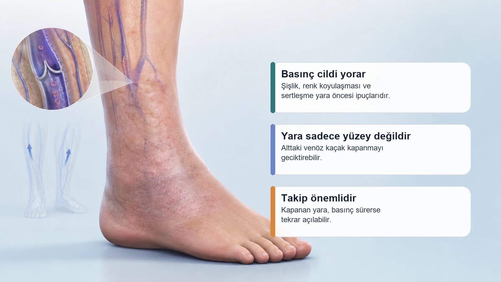 Venöz basınçla ayak bileği çevresinde cilt değişikliğini gösteren medikal görsel