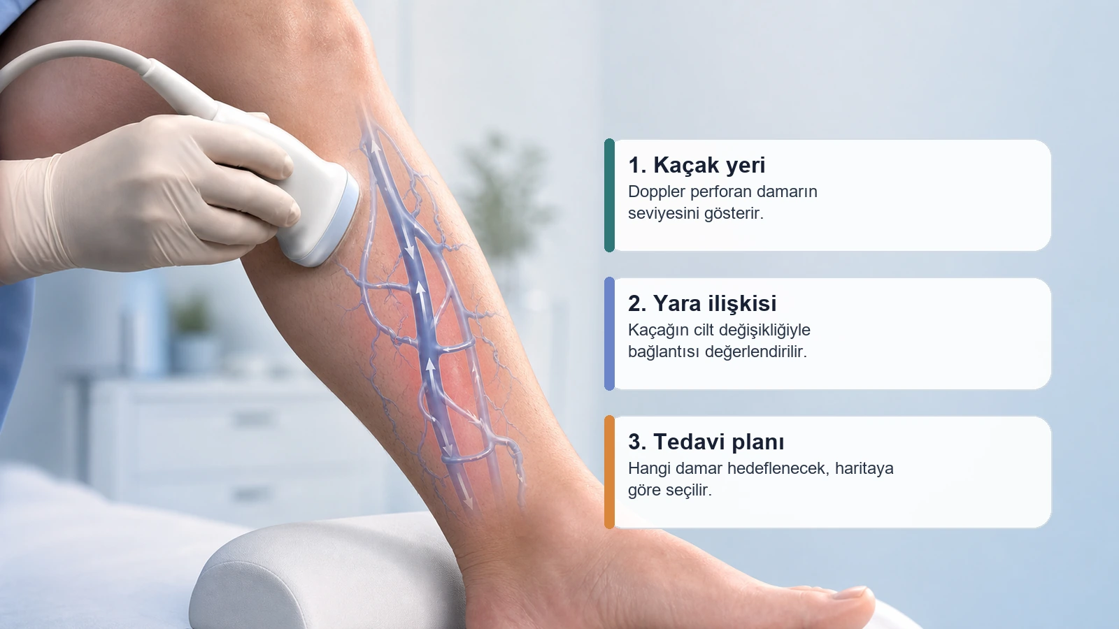 Doppler ultrason ile perforan ven kaçağının haritalanmasını gösteren medikal görsel
