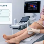 Hamilelik sonrası varis takibi için Doppler muayenesi yapılan bacak görseli