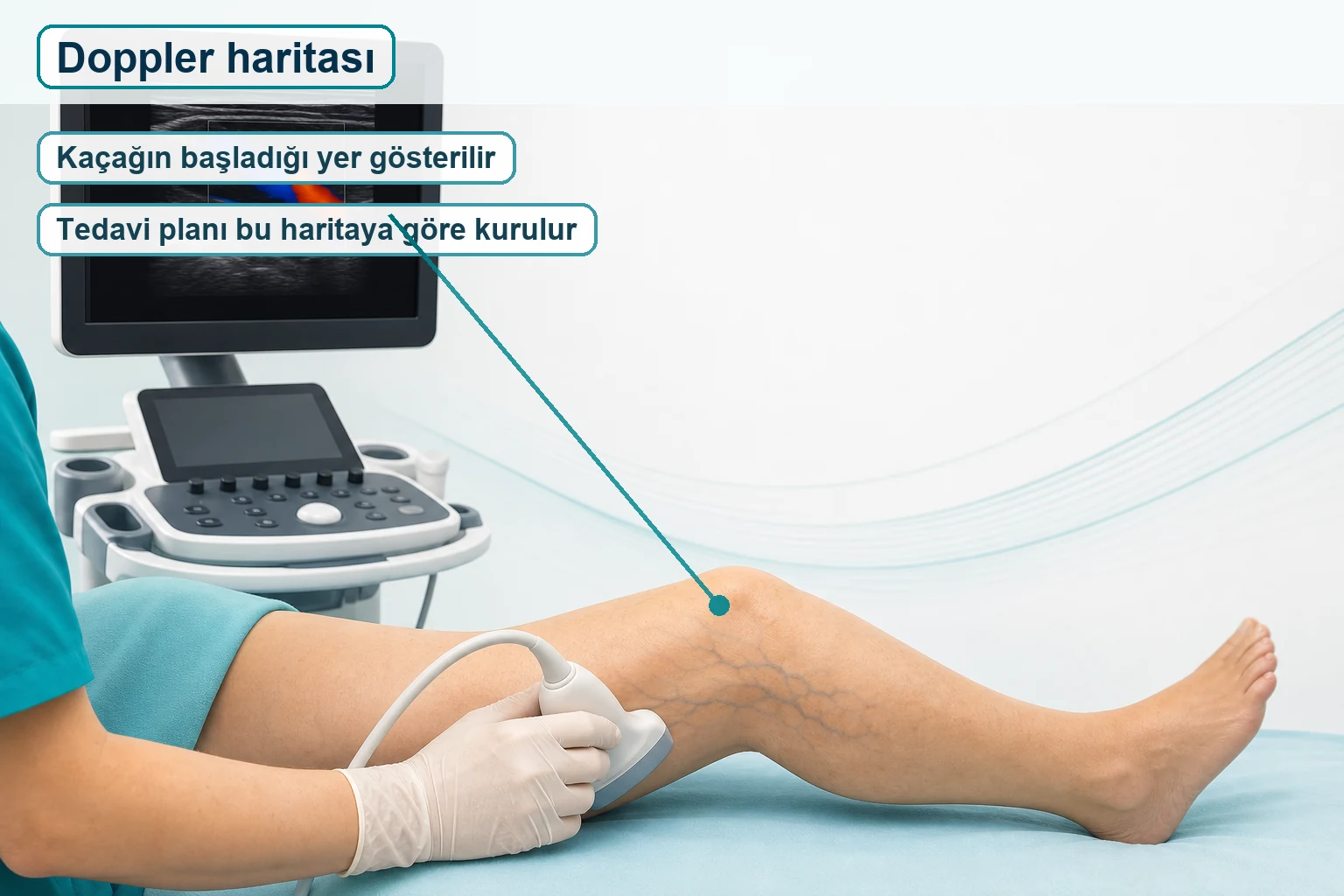 Doppler ultrasonla tekrarlayan variste kaçak kaynağının gösterilmesini anlatan tıbbi görsel