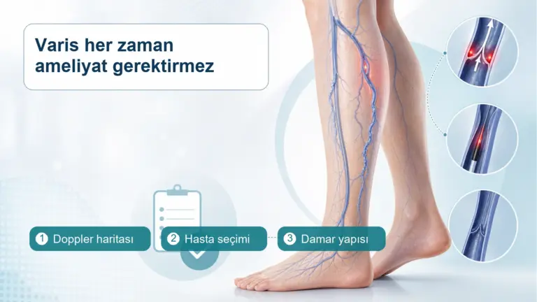 Varis Ameliyatsız Tedavi Edilebilir mi? Hangi Hastalarda Mümkün?