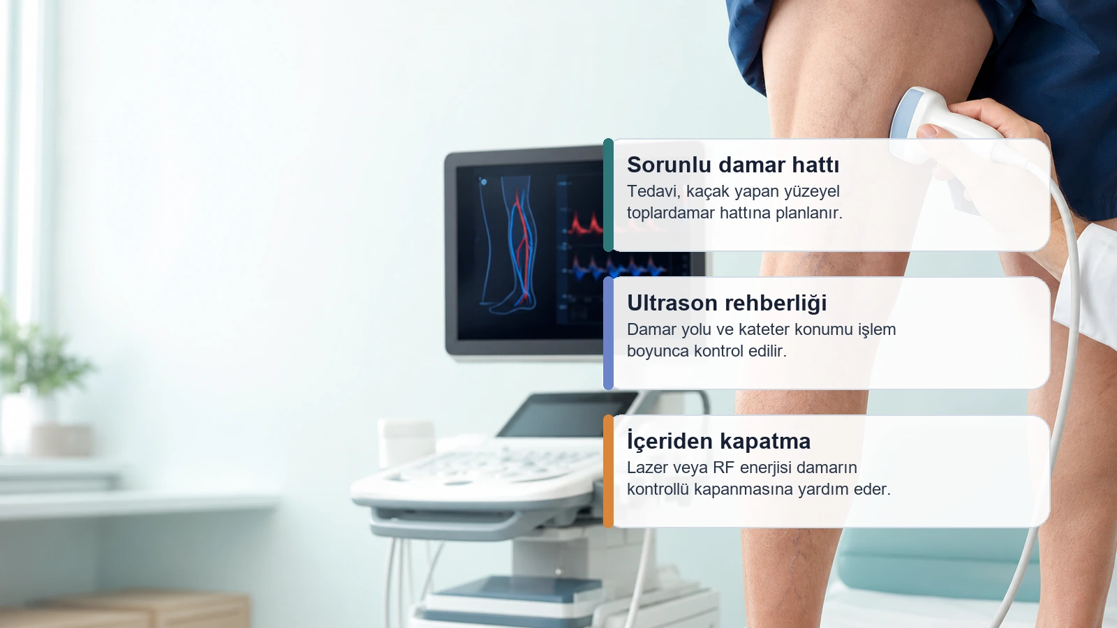 Varis Dopplerinde Safen Ven Yetmezliği Ne Anlama Gelir? için varis tedavisinde sorunlu damarın ultrason rehberliğinde içeriden kapatılmasını açıklayan premium medikal görsel