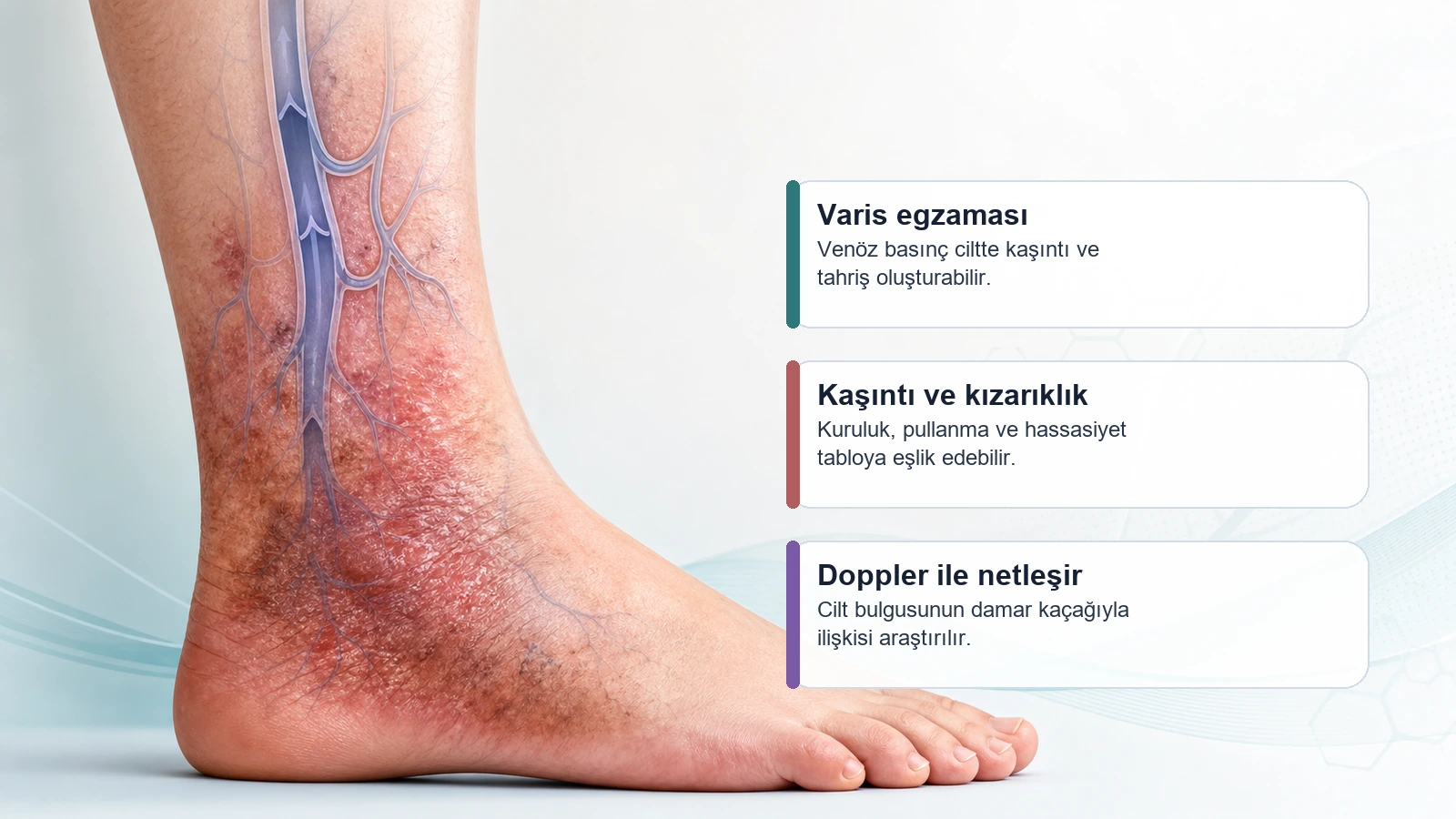 Varis egzaması, kaşıntı, kızarıklık ve cilt kalınlaşmasını anlatan medikal görsel