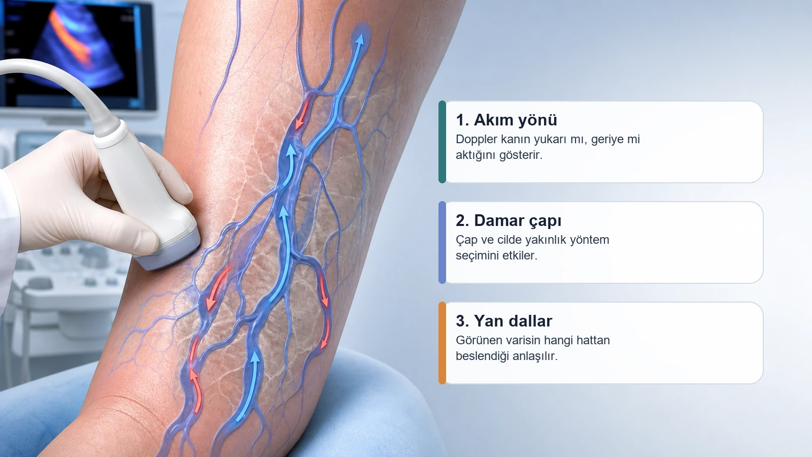 Doppler ultrason ile akım yönü damar çapı ve yan dalları gösteren varis haritalama görseli