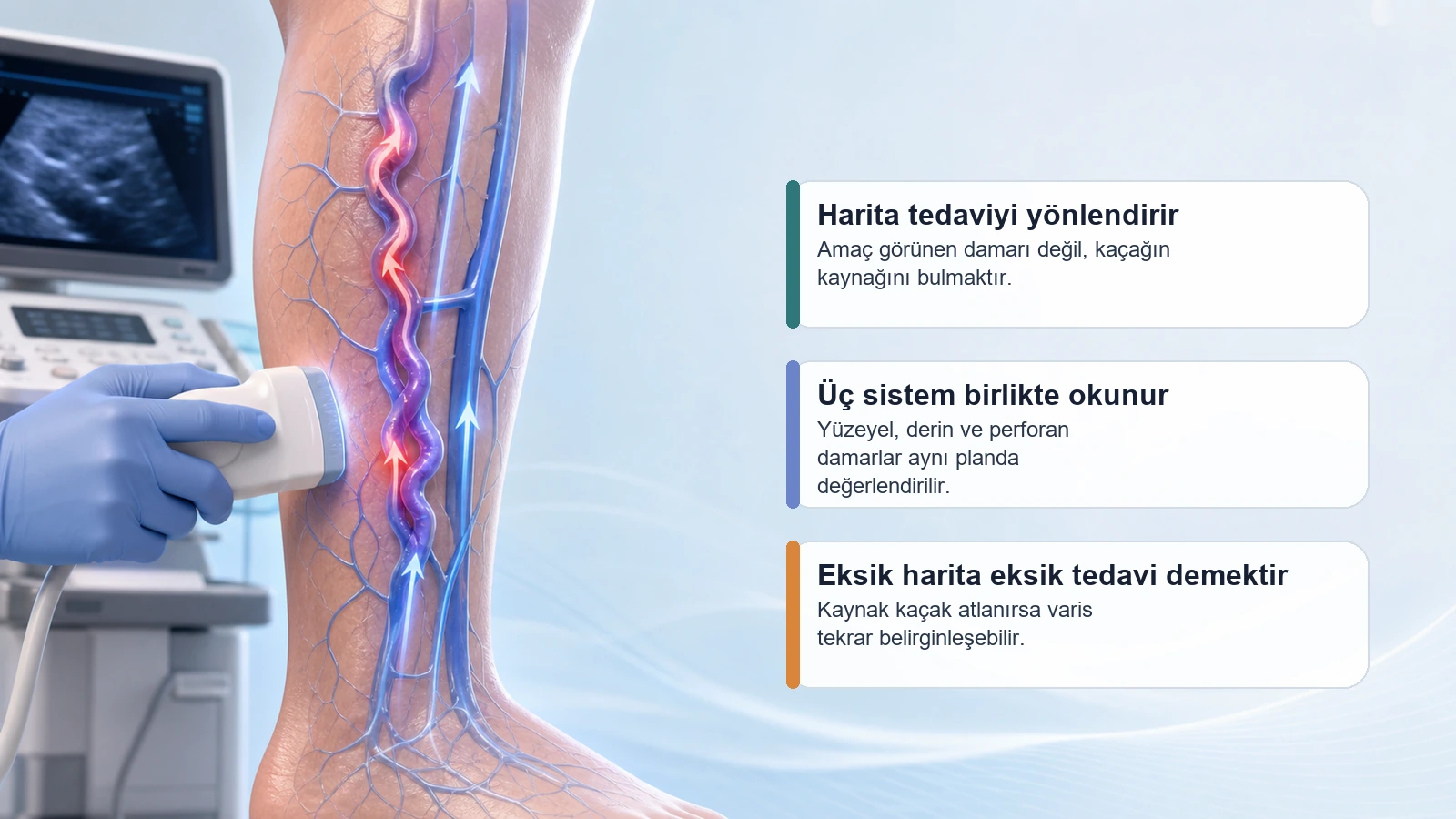 Varis haritalama için Doppler ile bacak damar yol haritasını gösteren medikal görsel