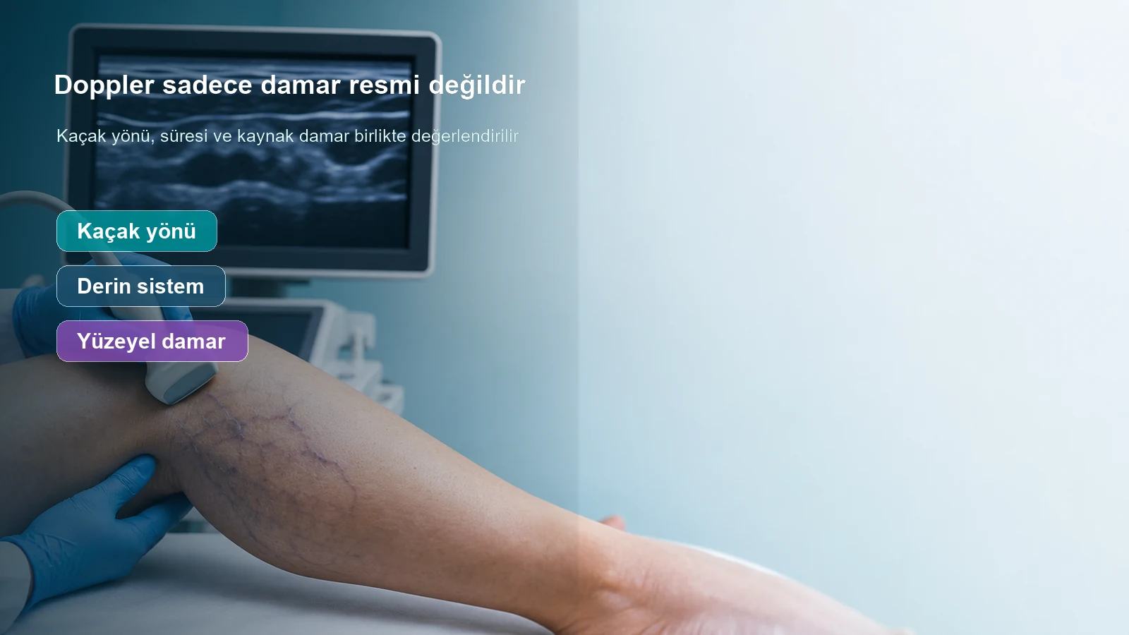 Varis değerlendirmesinde Doppler ultrasonun kaçak yönü ve damar sistemi bilgisini gösterdiğini anlatan görsel