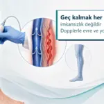 ?leri evre variste Doppler ile tedavi plan?n?n de?erlendirildi?ini g?steren medikal g?rsel.