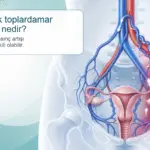 Yumurtalık toplardamar yetmezliğini ve pelvik venöz kaçak mekanizmasını gösteren tıbbi illüstrasyon