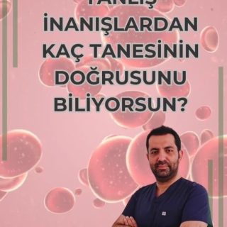 🩺 Varis Sadece Estetik Bir Sorundur Birçok kişi varisleri yalnızca estetik bir rahatsızlık olarak gö…